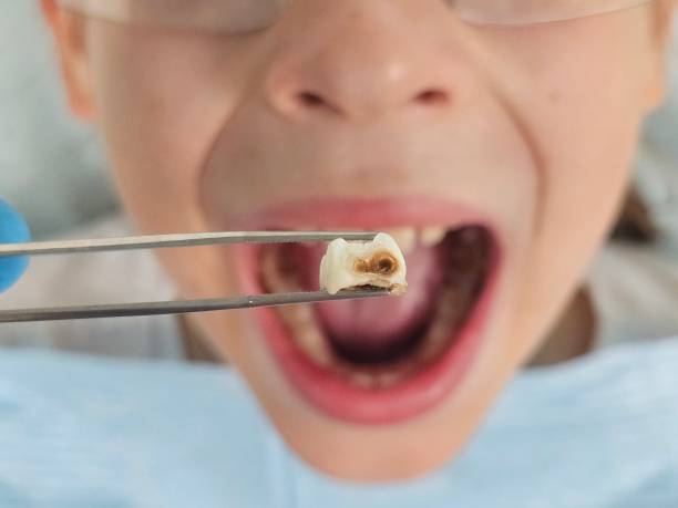 Best Emergency Treatment for Jaw Pain or Injury in Tice, FL